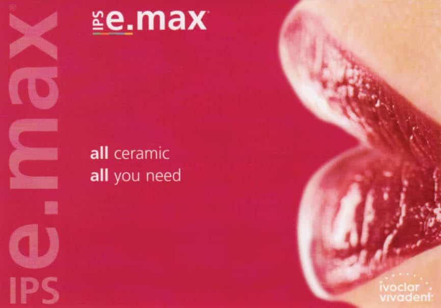 Cosmetic Emax Veneers Dental